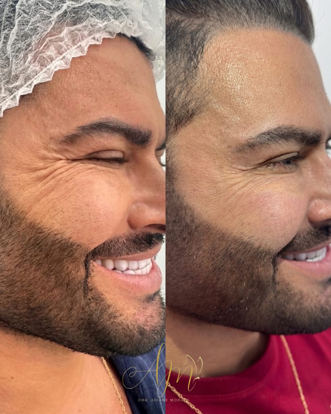 Evolução visível